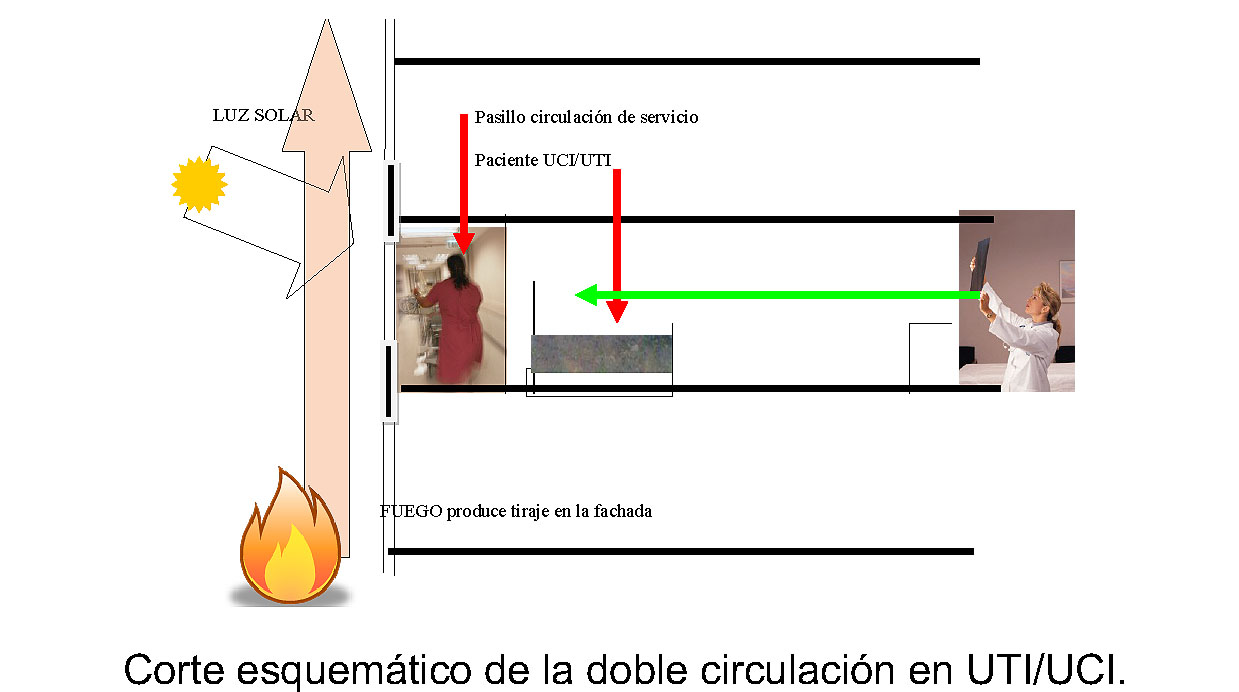 Corte esquemático de la doble circulación en UTI/UCI.